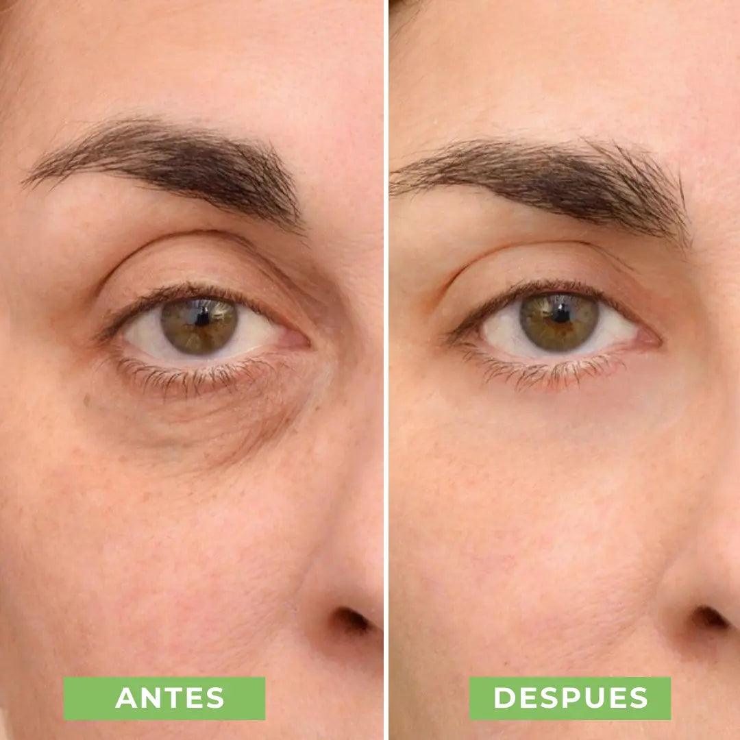 LiftGlow Ojos | Máscara Rejuvenecedora de Colágeno para el Contorno de Ojos - Bella Vanity